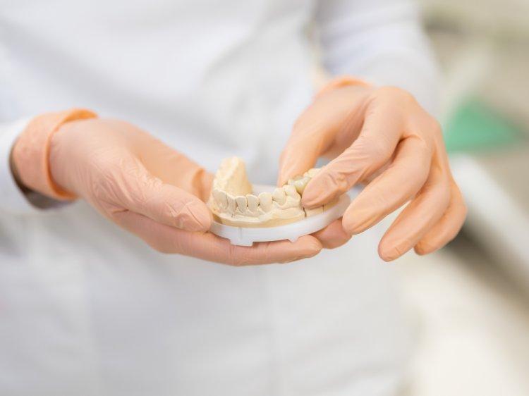 Stomatolog trzyma w dłoni odlew do aparatu ortodontycznego